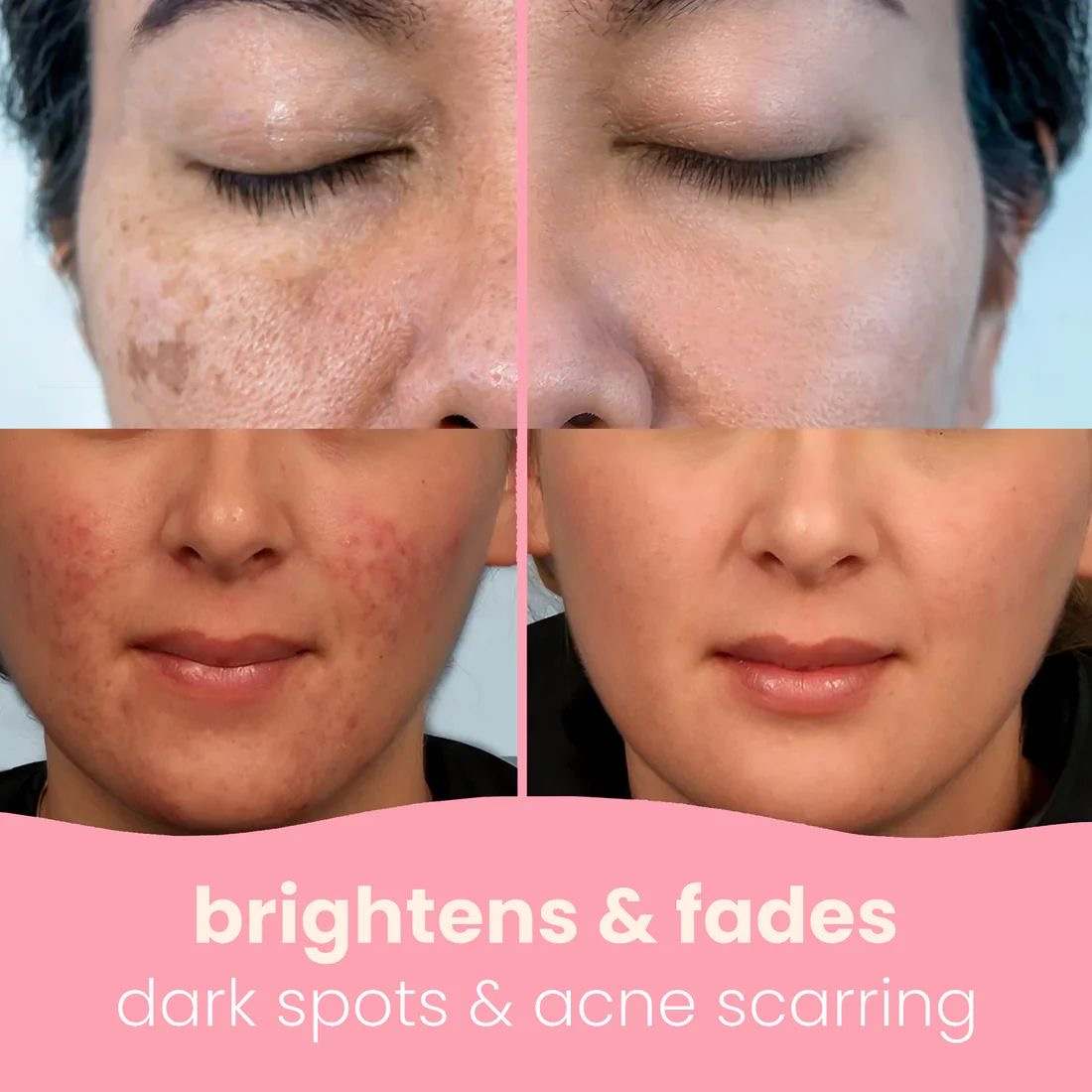 TUMERIC & KOJIC ACID PADS (40 pads)