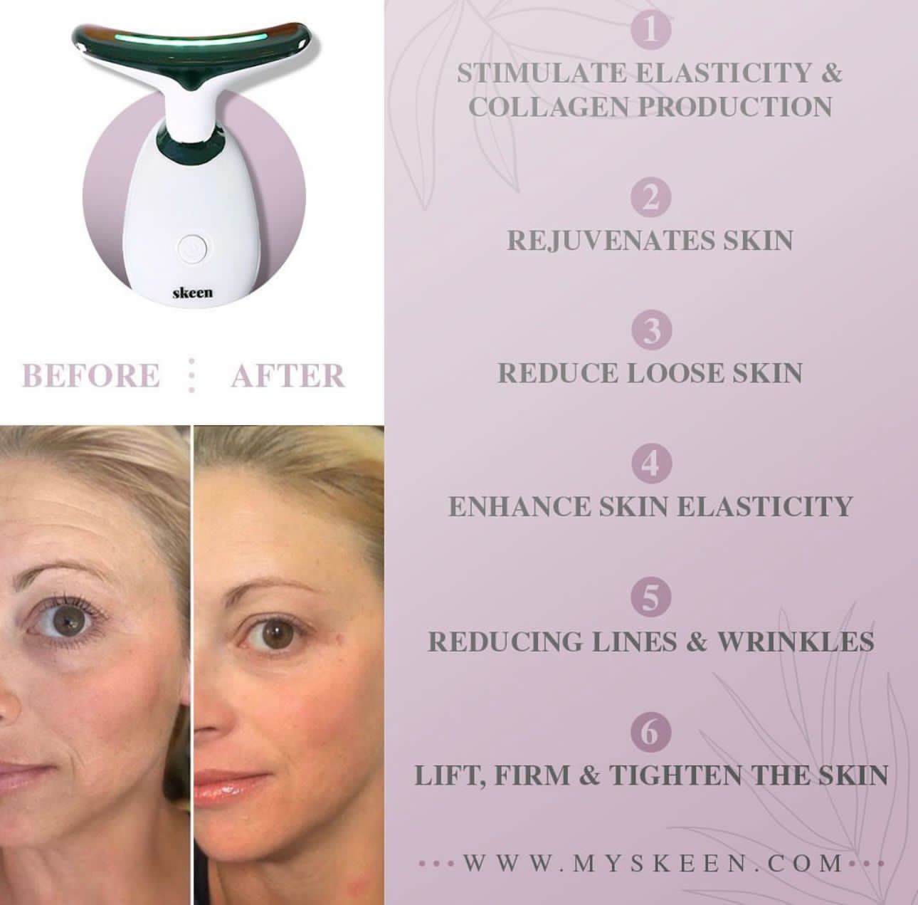 Skeen™ Facelifting Device